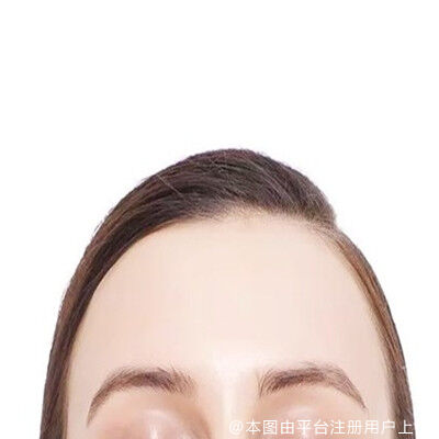 玻尿酸丰额头