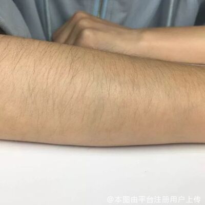脱手臂毛