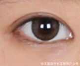 开外眼角