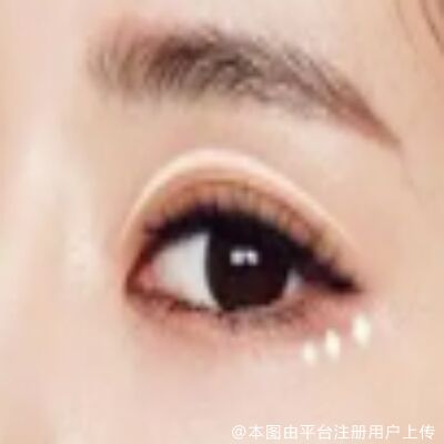 外切去眼袋