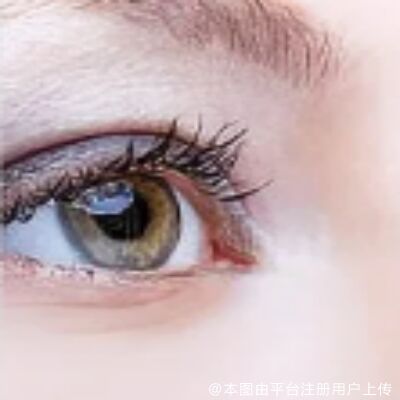 内切祛眼袋