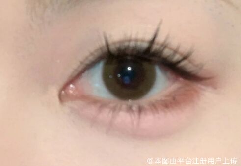 玻尿酸丰卧蚕