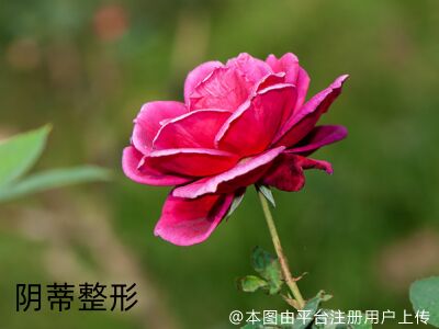 阴蒂整形术
