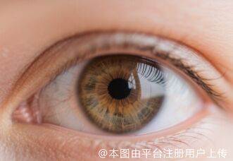 准分子激光术
